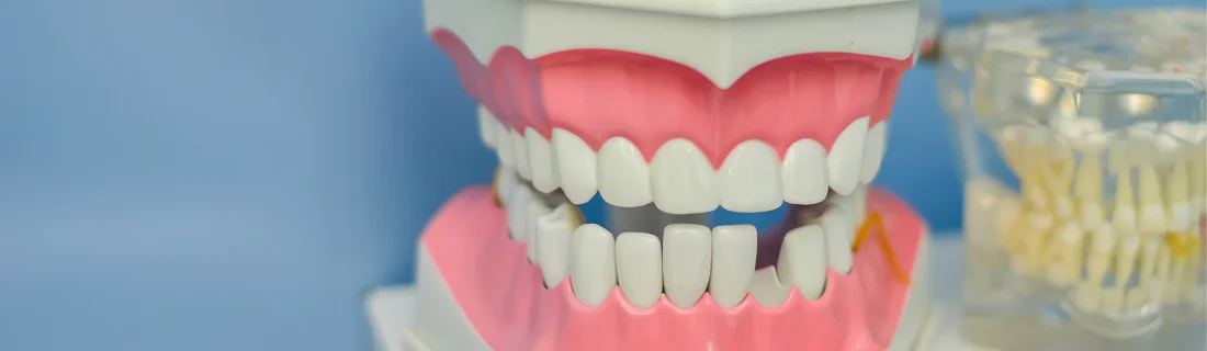 Cracked, Chipped or Broken Tooth Repair In Waterville ME