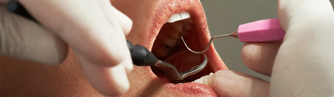 FC – Dental Checkups: Preventive Care at Waterville Family Dentistry in Waterville ME